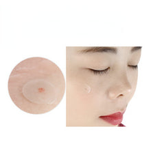 Load image into Gallery viewer, 36pcs/set Hydrocolloid Acne Invisible Pimple Master Patch Skin Tag

