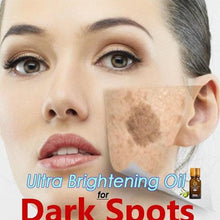 Load image into Gallery viewer, New Ultra Brightening Spotless Oil Skin Care Natural Pure Remove Ance
