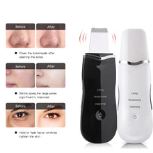 Load image into Gallery viewer, Ultrasonic Skin Scrubber Vibration Face Spatula Blackhead Remover
